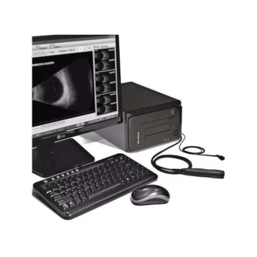 索维眼科AB超眼科超声诊断