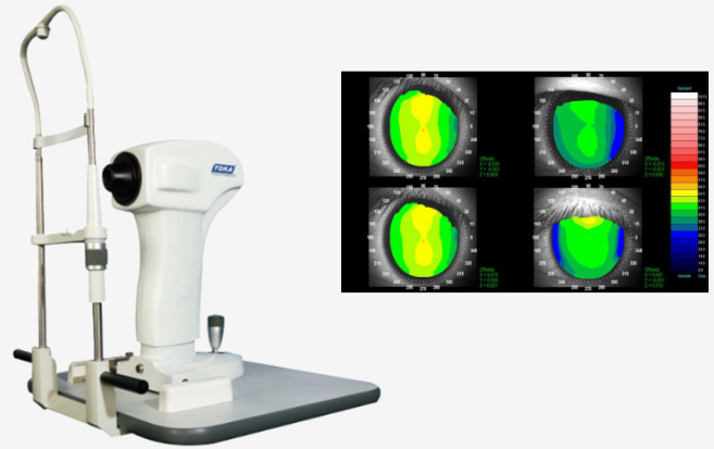 雷蒙光电角膜地形图 CT-6