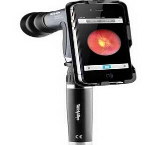 美国Welch Allyn iExaminer 便携式眼底相机