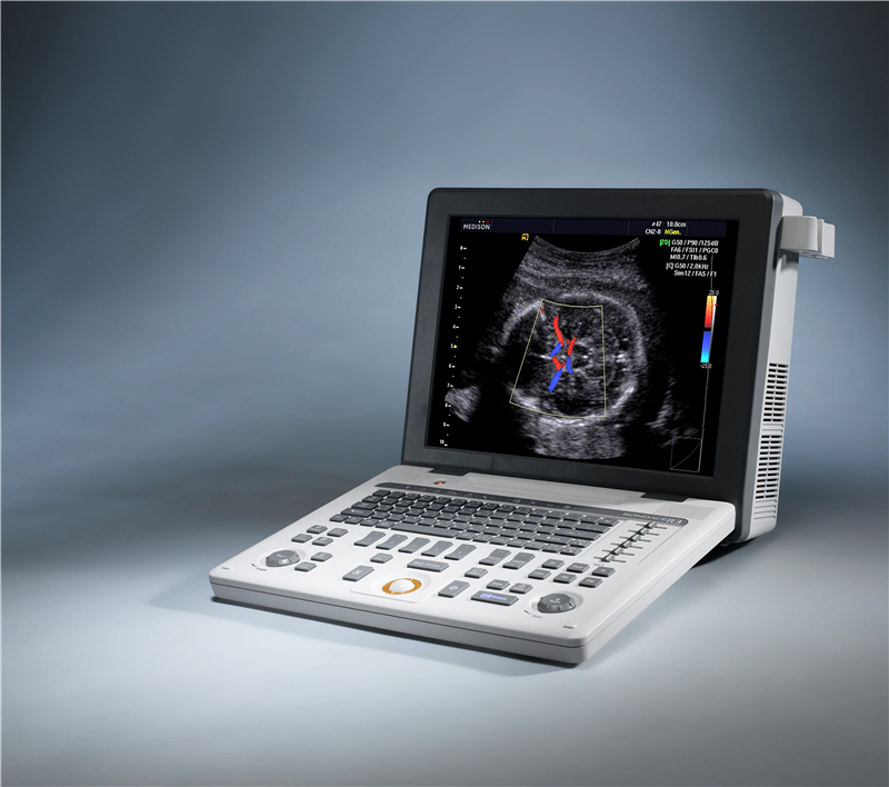 三星麦迪逊便携彩超SONOACE R3