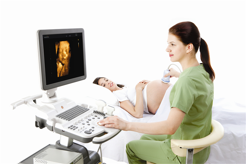 三星麦迪逊彩超SonoAce R7