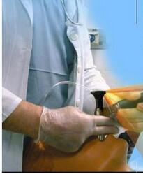 可视喉镜 Truview EVO2