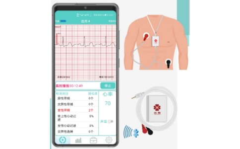 心狗动态心电图系统HWD系列