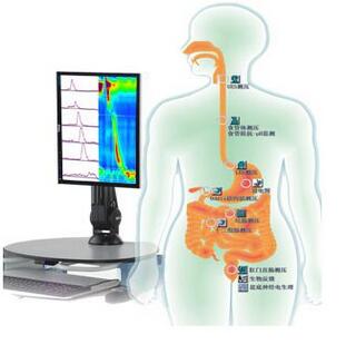 胃肠动力学检查系统 Solar GI