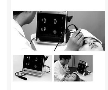 索维SW-2000眼科A/B超声诊断仪